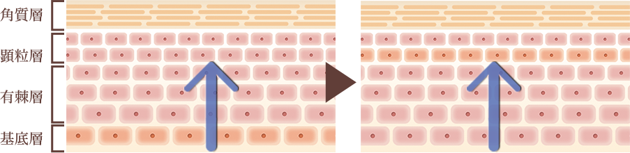 角質層イラスト